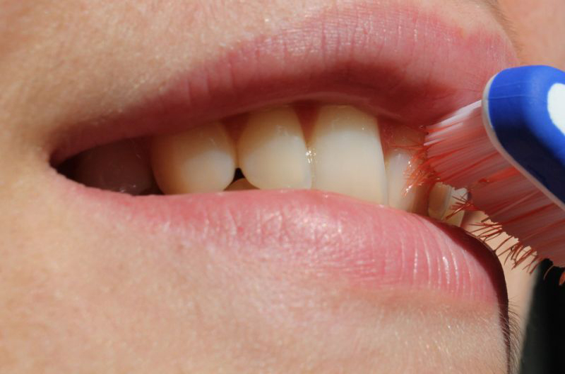 Señala especialista que malos hábitos afectan dentadura