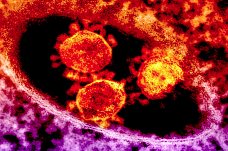 México no cuenta con ningún especialista en coronavirus: AMC