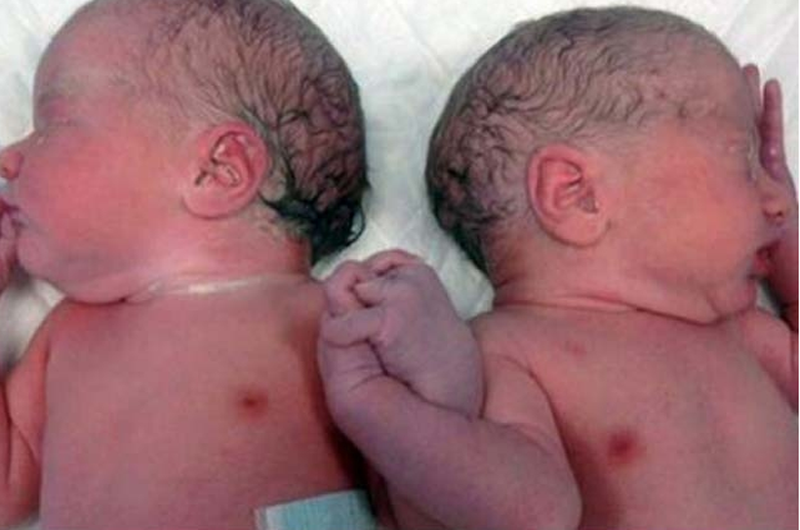 IMSS logra nacimiento de bebé 14 días después de la muerte de su gemela