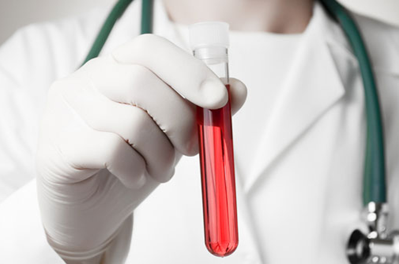 Detección de hemofilia debe realizarse en los primeros dos años de vida